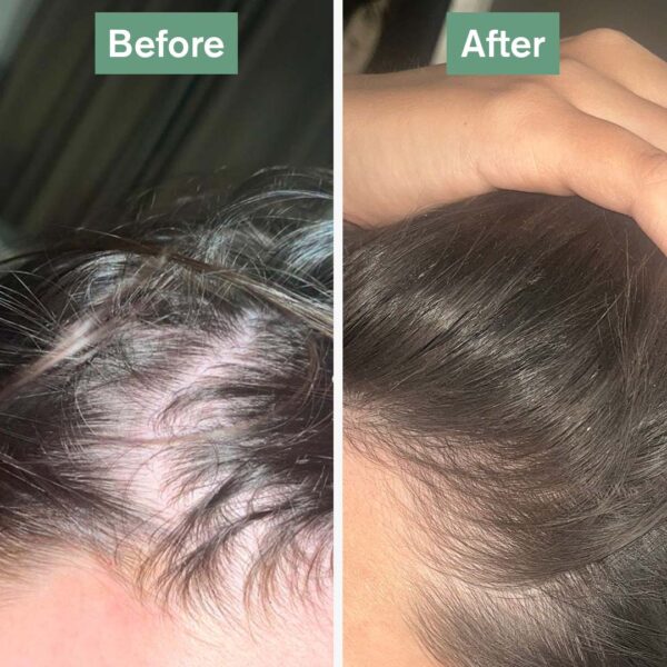 Hair Saviour® - Image 2